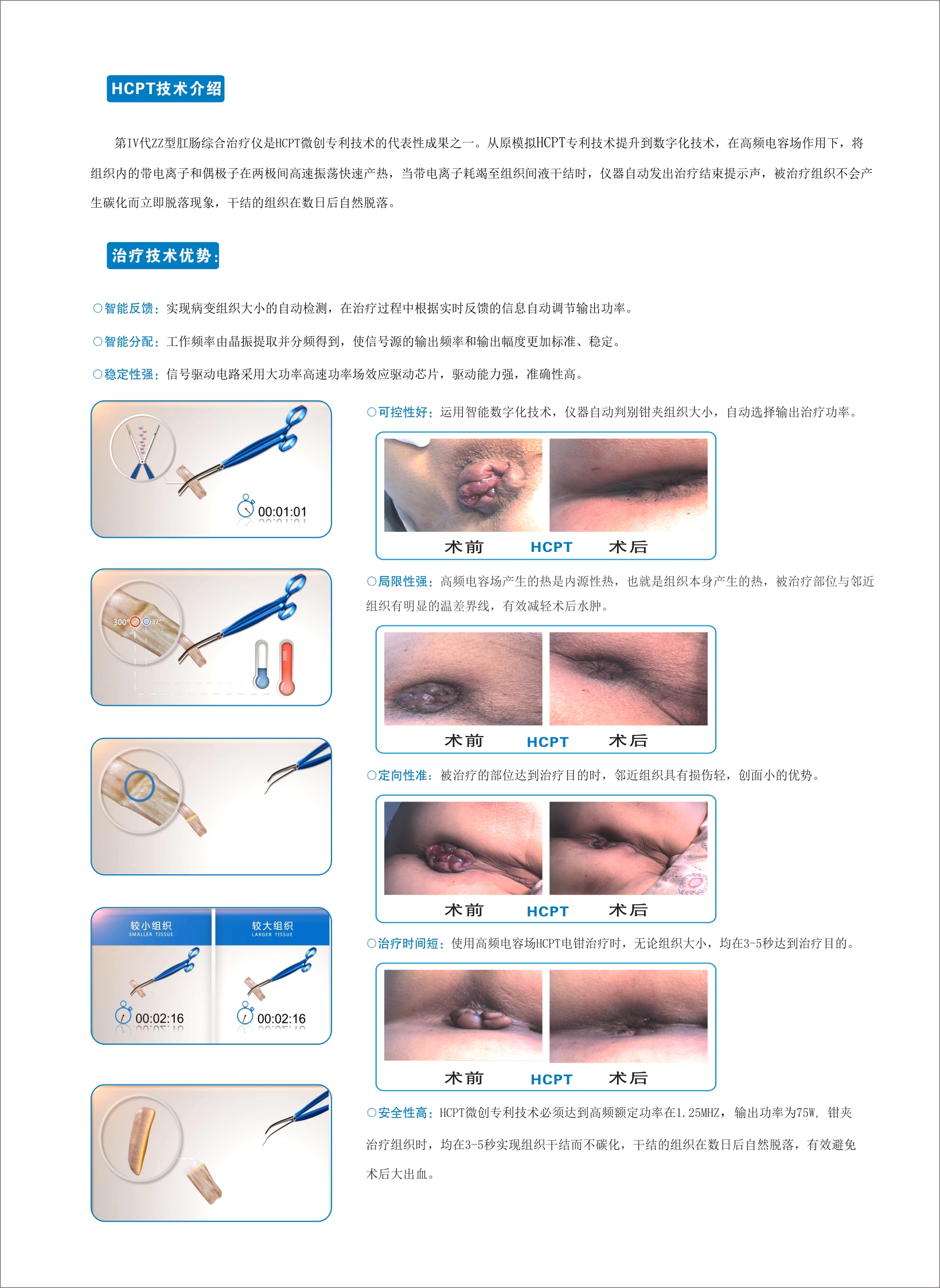 ZZ-IV500B-3.jpg ZZ-IV500B-3.jpg